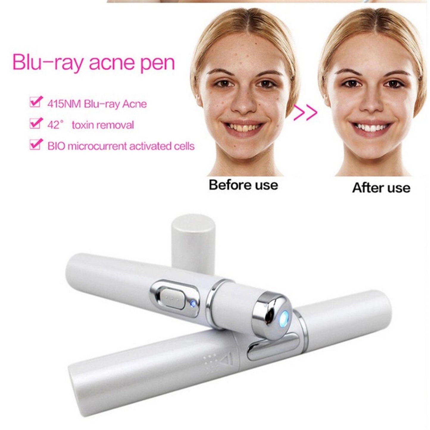 Stylo Anti - Acné à Lumière Bleue – Thérapie LED 415 nm - ReveliaBeauty