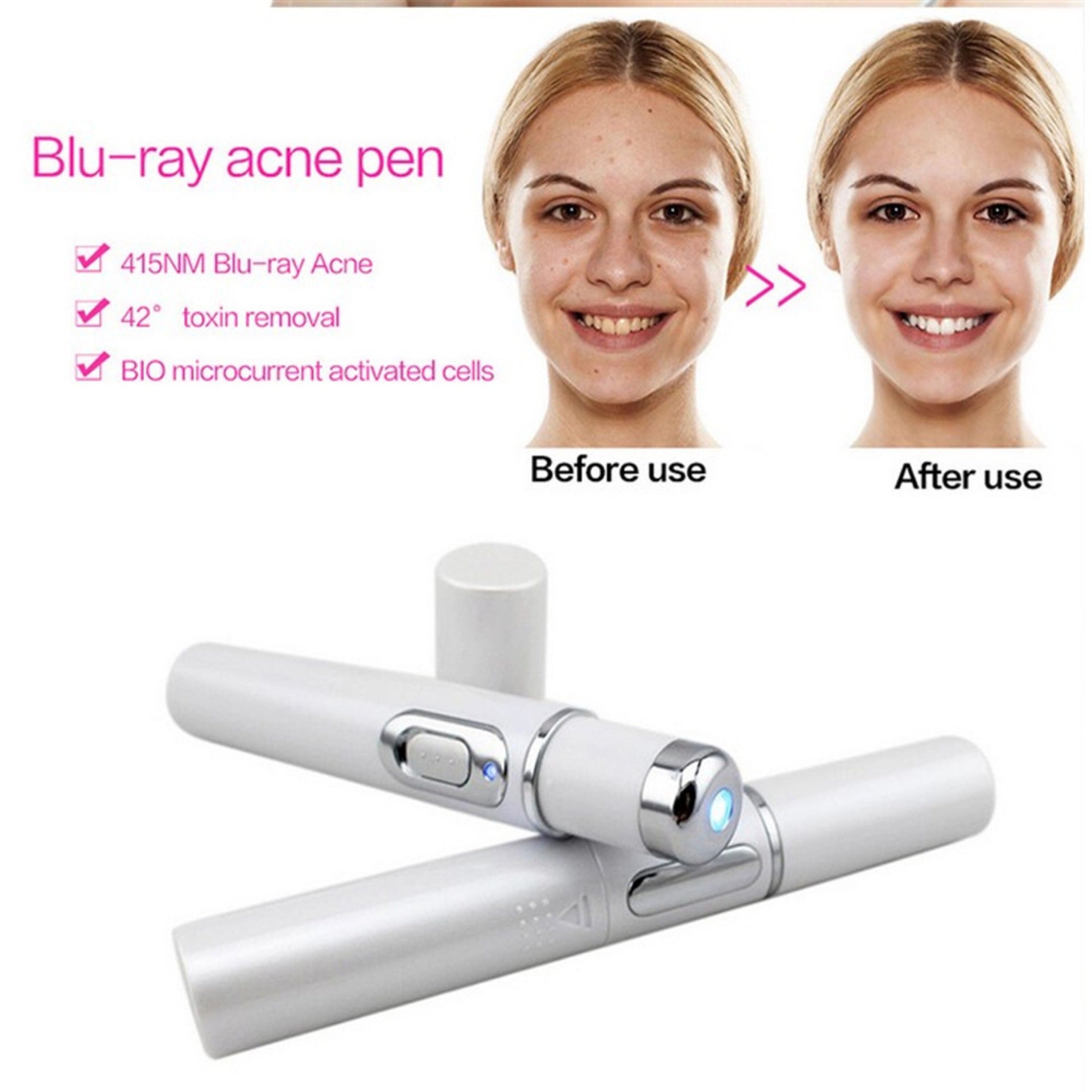 Stylo Anti - Acné à Lumière Bleue – Thérapie LED 415 nm - ReveliaBeauty