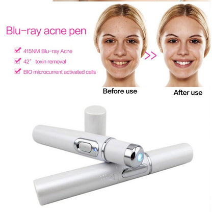 Stylo Anti - Acné à Lumière Bleue – Thérapie LED 415 nm - ReveliaBeauty